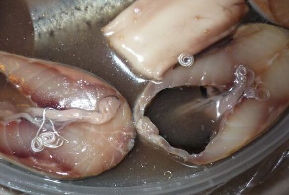 Vías de infección en humanos a través de parásitos.