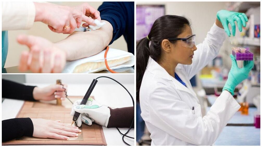 Métodos de diagnóstico para detectar parásitos en el cuerpo.