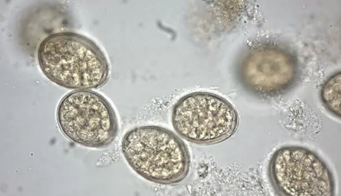 Parásitos bajo el microscopio.