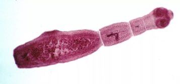 Cómo deshacerse de los parásitos en el cuerpo humano