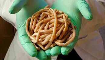 Métodos para eliminar los parásitos del cuerpo