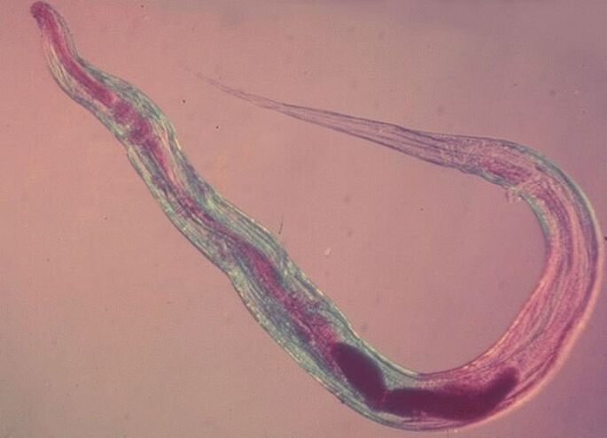 Oxiuros bajo el microscopio