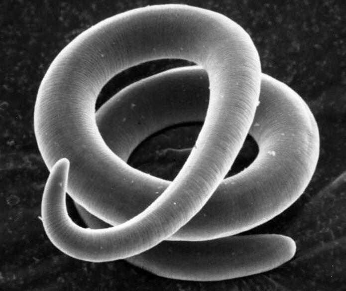 Trichinella bajo el microscopio